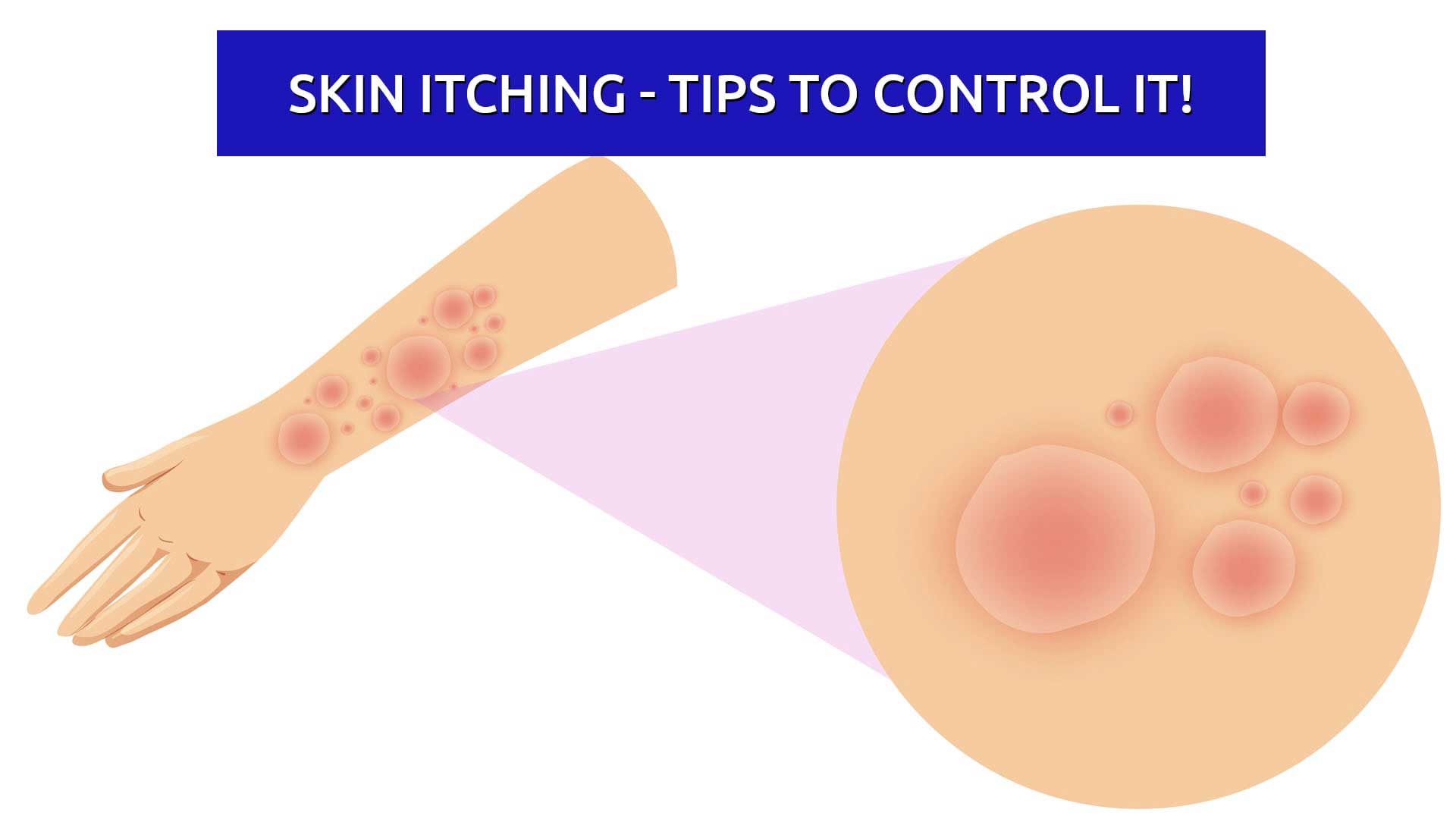 Skin Itching – Tips To Control It!