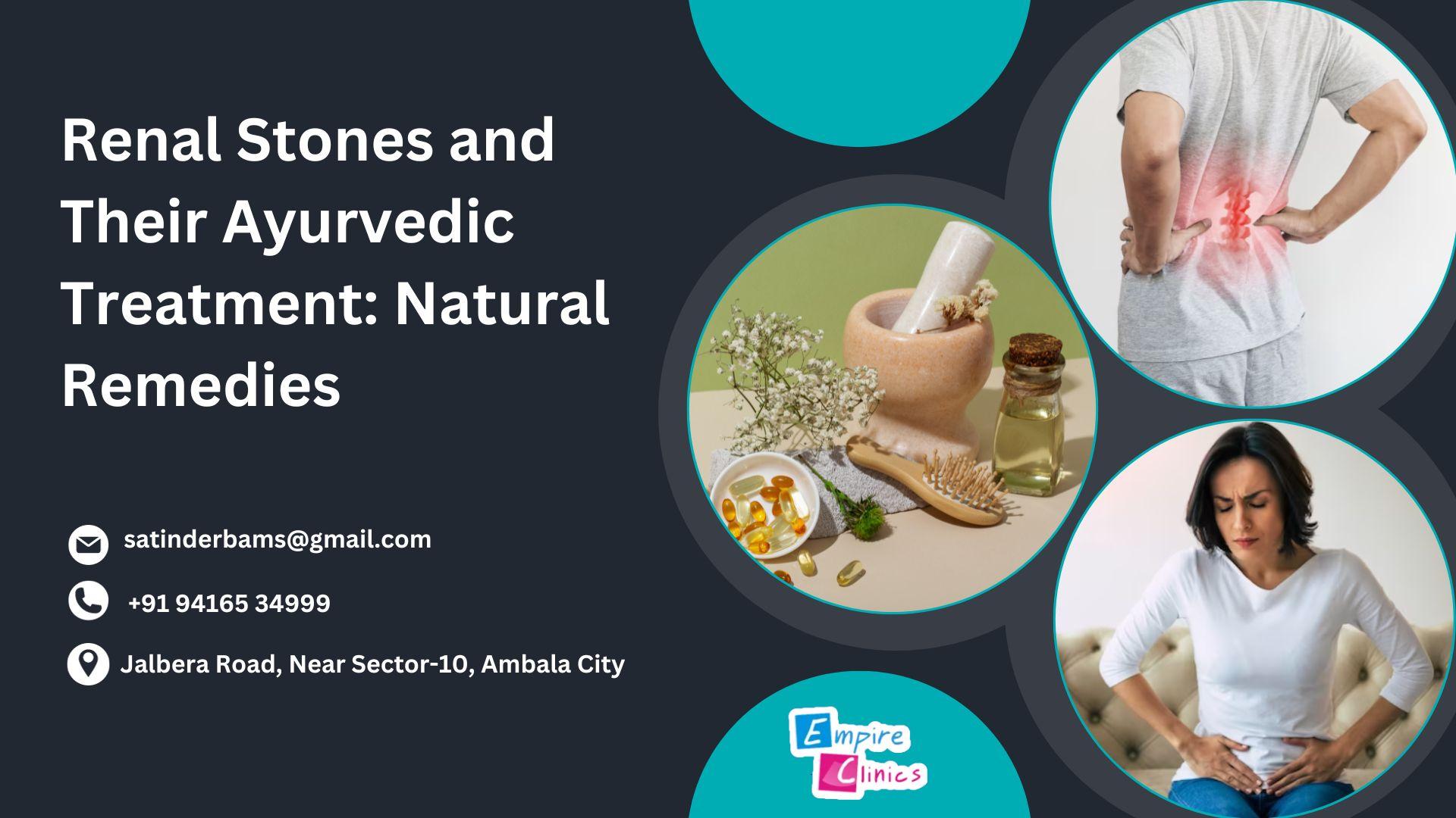 Renal Stones and Their Ayurvedic Treatment: Natural Remedies