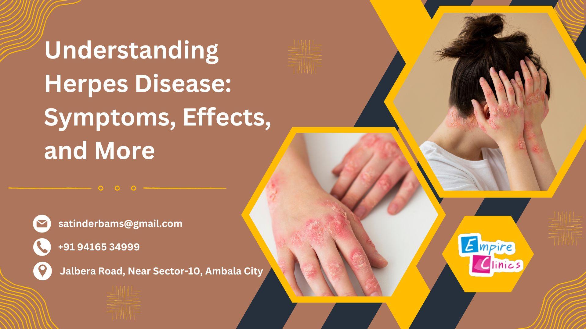 understanding-herpes-disease-symptoms-effects-and-more