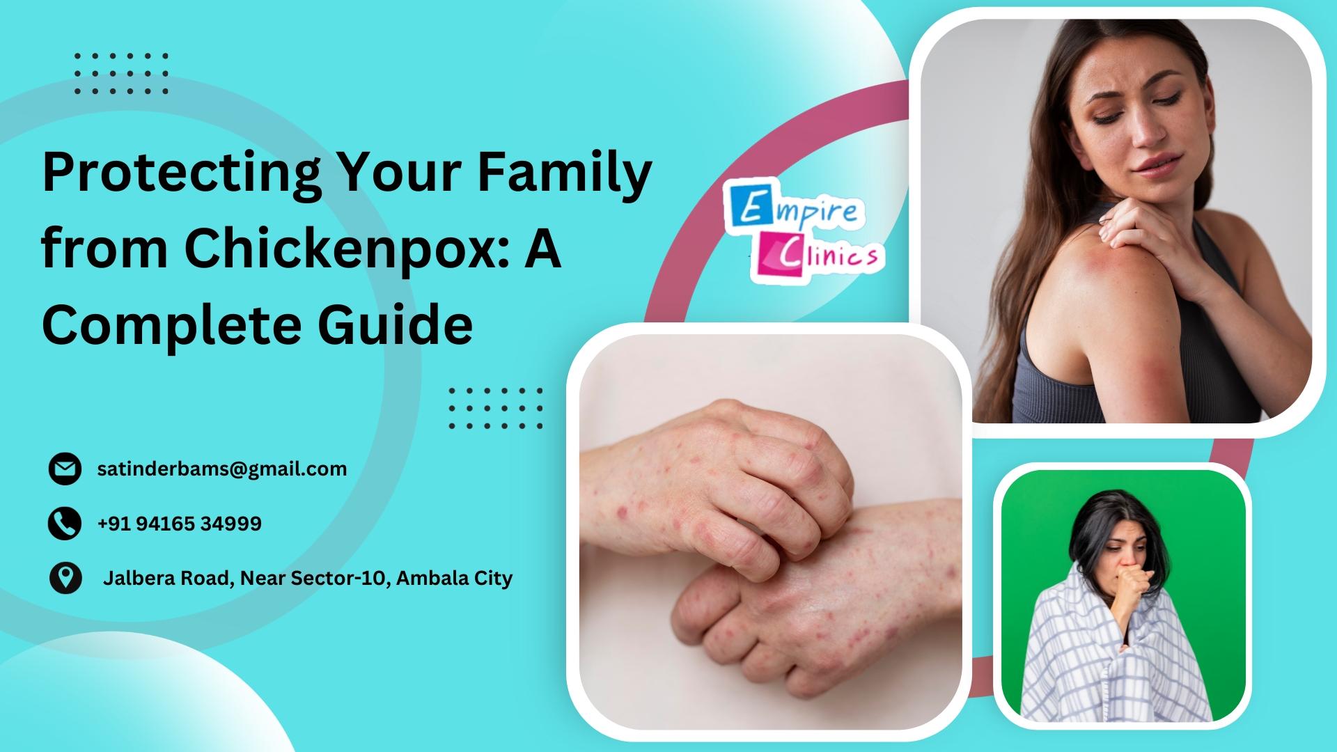 Protecting Your Family from Chickenpox: A Complete Guide